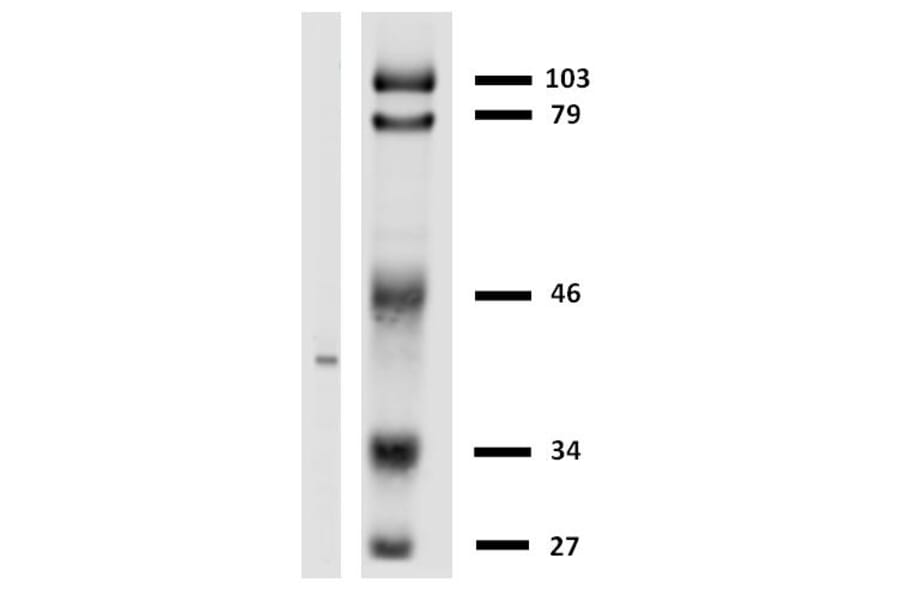 Western Blot - Anti-HLA G Antibody [MEM-G/2] (A86170) - Antibodies.com