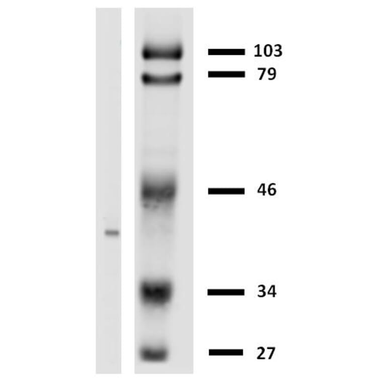 Western Blot - Anti-HLA G Antibody [MEM-G/2] (A86170) - Antibodies.com