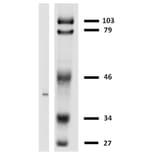 Western Blot - Anti-HLA G Antibody [MEM-G/2] (A86170) - Antibodies.com