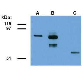 WB - Anti-ABRA1 Antibody [ABRA1-01] (A86190)