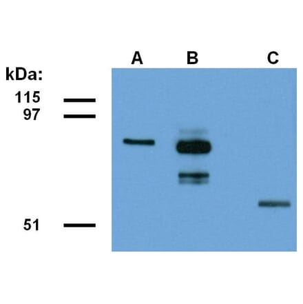 WB - Anti-ABRA1 Antibody [ABRA1-01] (A86190)