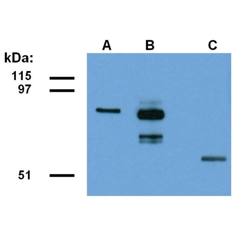 WB - Anti-ABRA1 Antibody [ABRA1-01] (A86190)