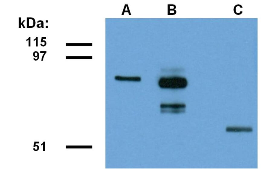 Western Blot - Anti-ABRA1 Antibody [ABRA1-01] (A86187) - Antibodies.com