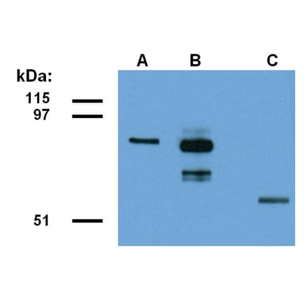 Western Blot - Anti-ABRA1 Antibody [ABRA1-01] (A86187) - Antibodies.com