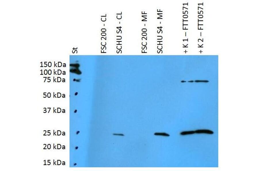 WB - Anti-F. tularensis ssp. tularensis FTT0571 Antibody (A86210)