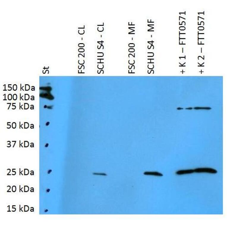 WB - Anti-F. tularensis ssp. tularensis FTT0571 Antibody (A86210)