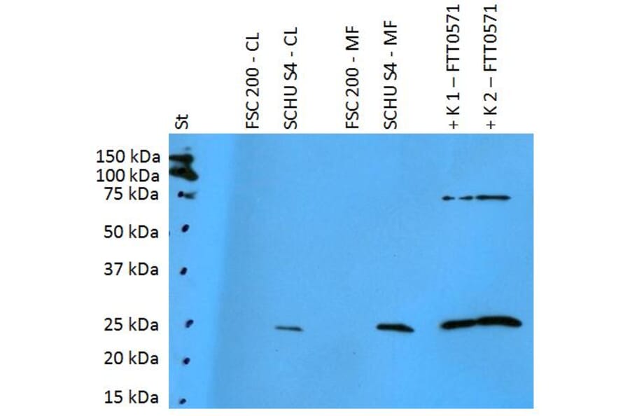 Western Blot - Anti-F. tularensis ssp. holarctica FTT0571 Antibody (A86209) - Antibodies.com