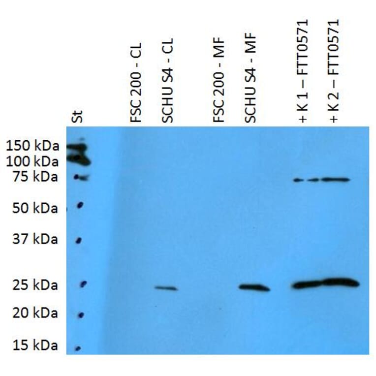 Western Blot - Anti-F. tularensis ssp. holarctica FTT0571 Antibody (A86209) - Antibodies.com
