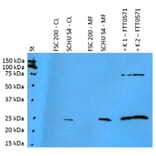 Western Blot - Anti-F. tularensis ssp. holarctica FTT0571 Antibody (A86209) - Antibodies.com
