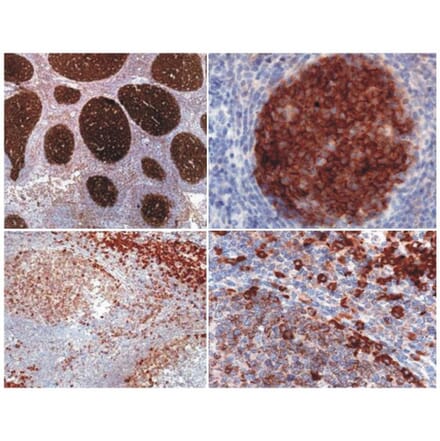 Immunohistochemistry - Anti-PAG1 Antibody [MEM-255] (A86212) - Antibodies.com