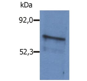 WB - Anti-BLNK Antibody (A86222)