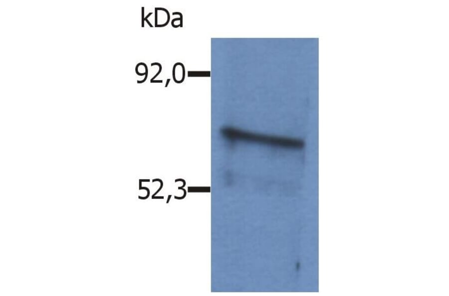 WB - Anti-BLNK Antibody (A86222)