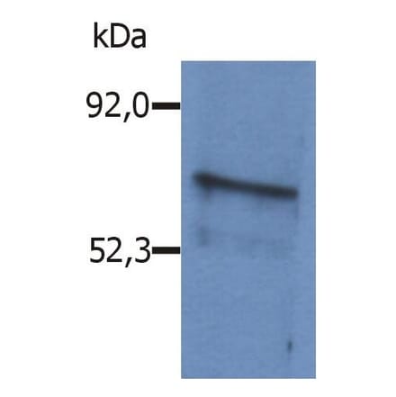 WB - Anti-BLNK Antibody (A86222)
