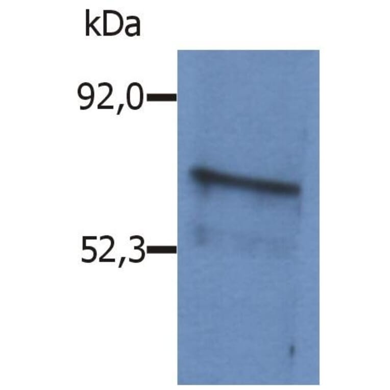 WB - Anti-BLNK Antibody (A86222)