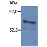 WB - Anti-BLNK Antibody (A86222)