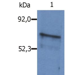 Western Blot - Anti-BLNK Antibody (A86221) - Antibodies.com