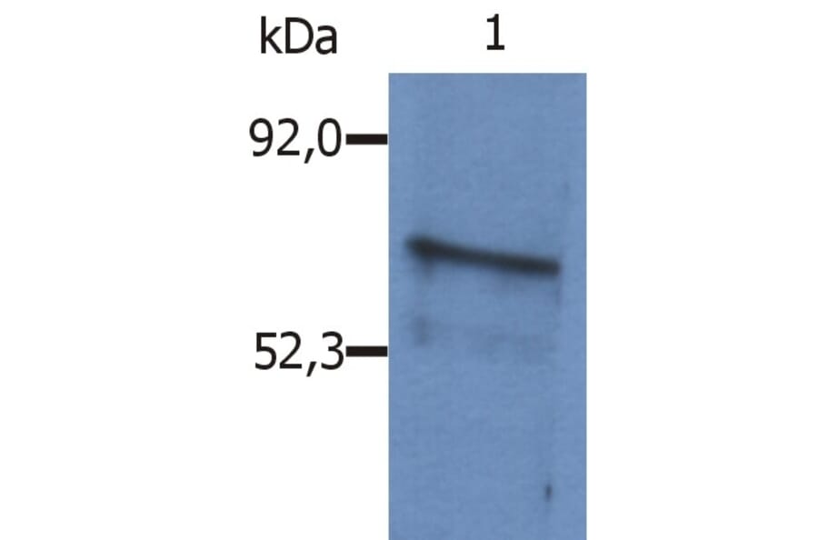 Western Blot - Anti-BLNK Antibody (A86221) - Antibodies.com