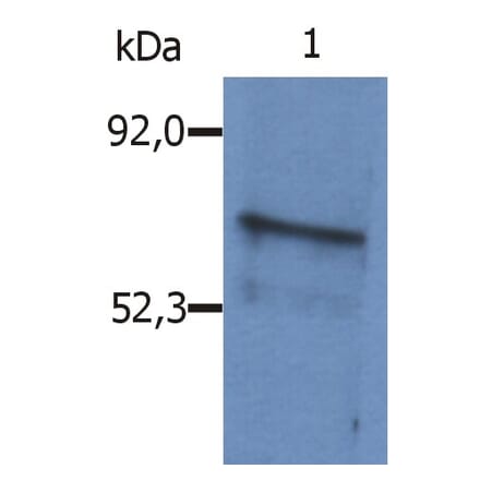 Western Blot - Anti-BLNK Antibody (A86221) - Antibodies.com