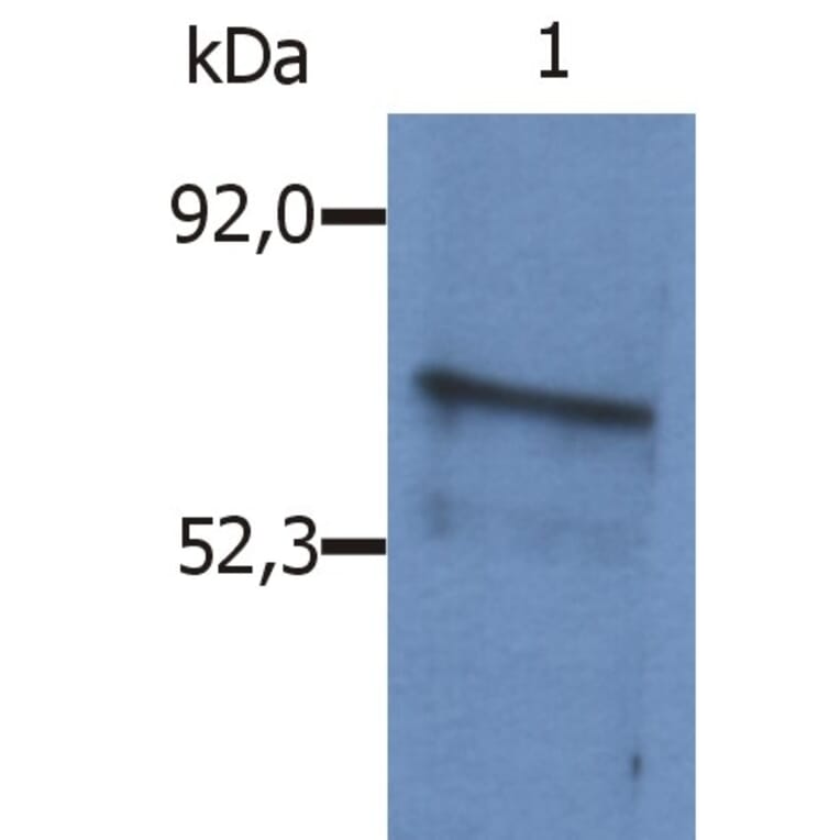 Western Blot - Anti-BLNK Antibody (A86221) - Antibodies.com