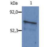 Western Blot - Anti-BLNK Antibody (A86221) - Antibodies.com