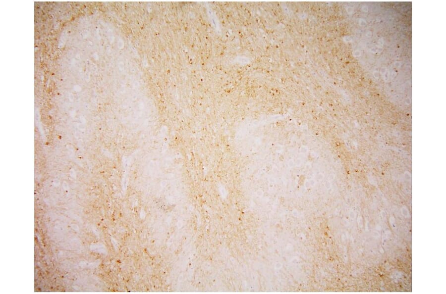 IHC - Anti-PSMA Antibody [GCP-04] (A86232)