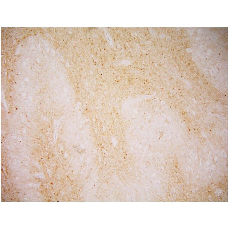 IHC - Anti-PSMA Antibody [GCP-04] (A86232)