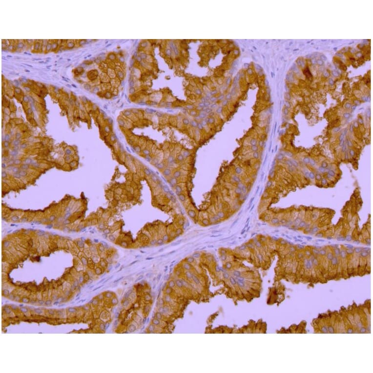IHC - Anti-PSMA Antibody [GCP-04] (A86232)