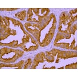 IHC - Anti-PSMA Antibody [GCP-04] (A86232)