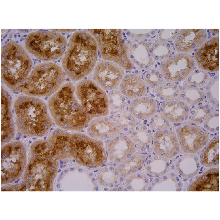 IHC - Anti-PSMA Antibody [GCP-04] (A86232)