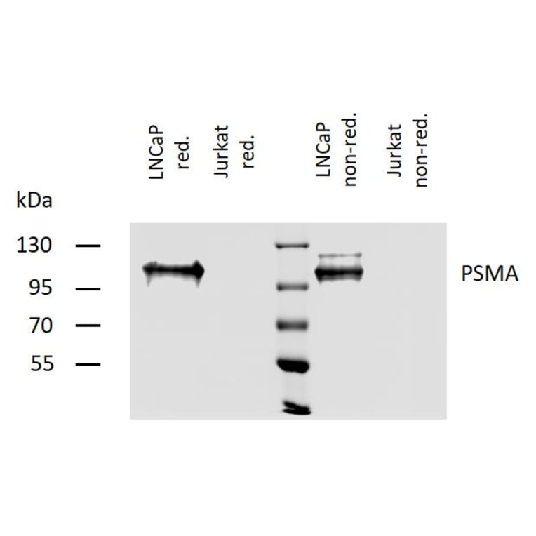 WB - Anti-PSMA Antibody [GCP-04] (A86232)