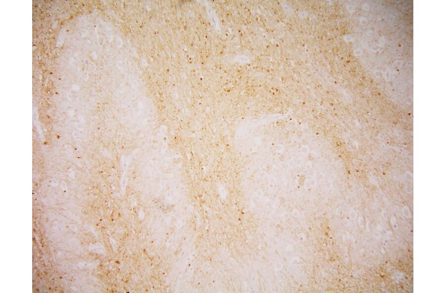 Immunohistochemistry - Anti-PSMA Antibody [GCP-04] (A86228) - Antibodies.com