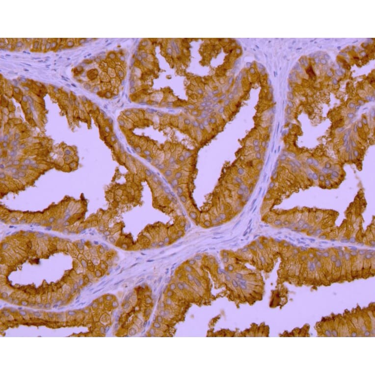 Immunohistochemistry - Anti-PSMA Antibody [GCP-04] (A86232) - Antibodies.com