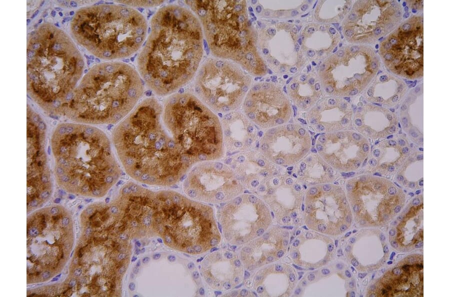 Immunohistochemistry - Anti-PSMA Antibody [GCP-04] (A86232) - Antibodies.com