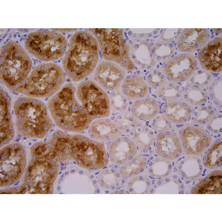 Immunohistochemistry - Anti-PSMA Antibody [GCP-04] (A86232) - Antibodies.com