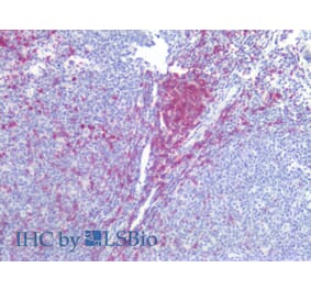 IHC - Anti-CD5 Antibody [L17F12] (A86239)