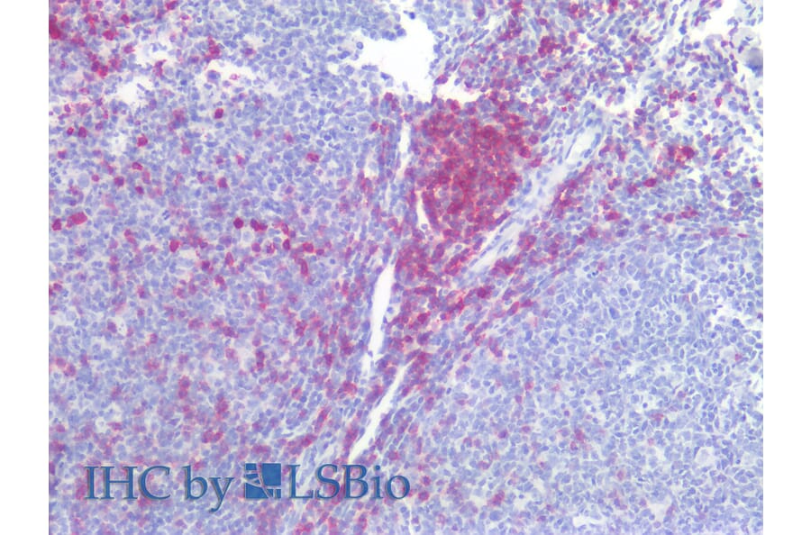 IHC - Anti-CD5 Antibody [L17F12] (A86239)