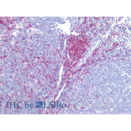 IHC - Anti-CD5 Antibody [L17F12] (A86239)