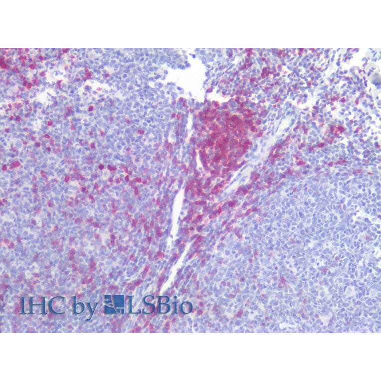 IHC - Anti-CD5 Antibody [L17F12] (A86239)