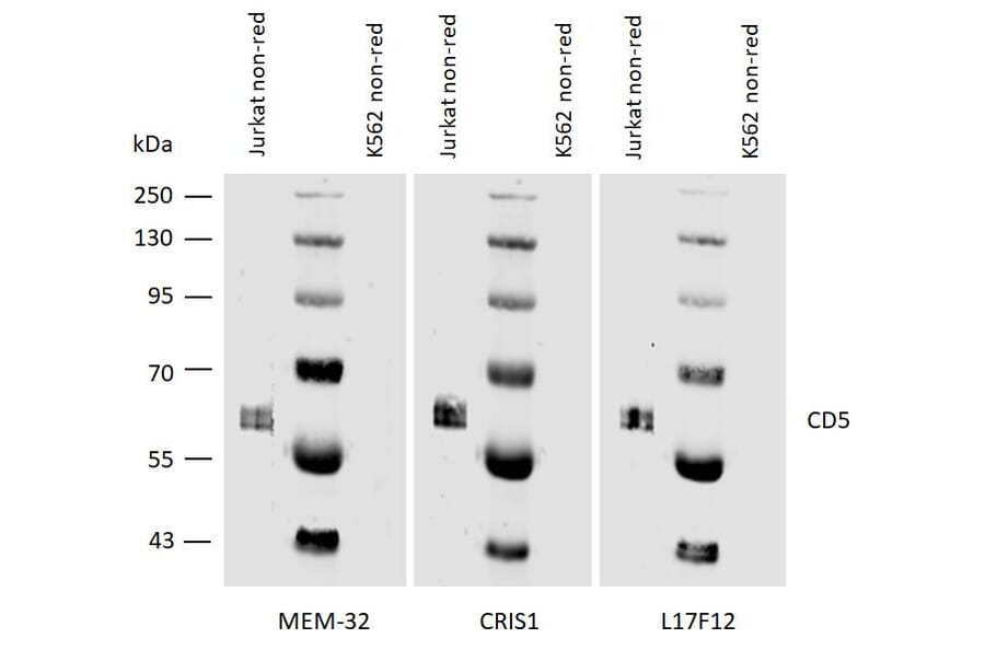 WB - Anti-CD5 Antibody [L17F12] (A86239)