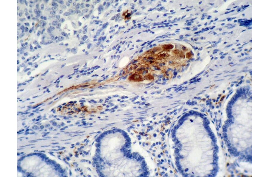Immunohistochemistry - Anti-p21WAF Antibody [WA-1] (A86253) - Antibodies.com