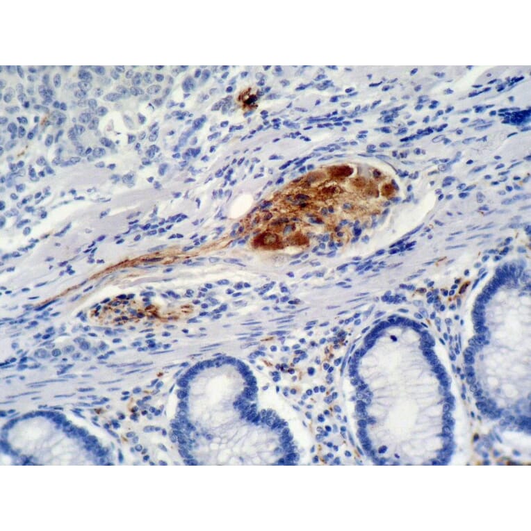 Immunohistochemistry - Anti-p21WAF Antibody [WA-1] (A86253) - Antibodies.com