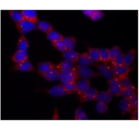 ICC - Anti-gamma Tubulin Antibody [TU-30] (A86254)