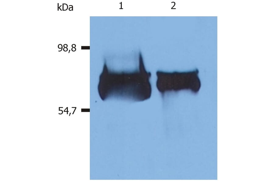 WB - Anti-Human Serum Albumin Antibody [AL-01] (A86266)