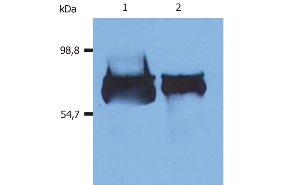 Western Blot - Anti-Albumin Antibody [AL-01] (A86254) - Antibodies.com