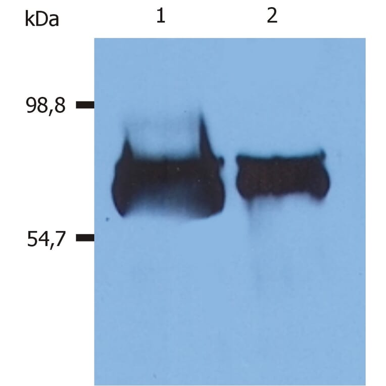 Western Blot - Anti-Albumin Antibody [AL-01] (A86254) - Antibodies.com