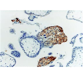 IHC - Anti-HLA G Antibody [MEM-G/1] (A86276)