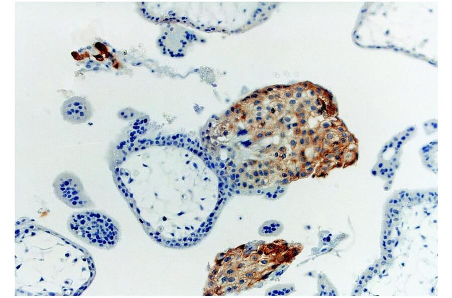 IHC - Anti-HLA G Antibody [MEM-G/1] (A86276)