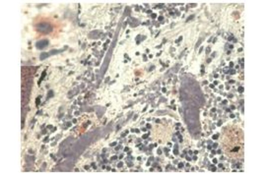 IHC - Anti-HLA G Antibody [MEM-G/1] (A86276)