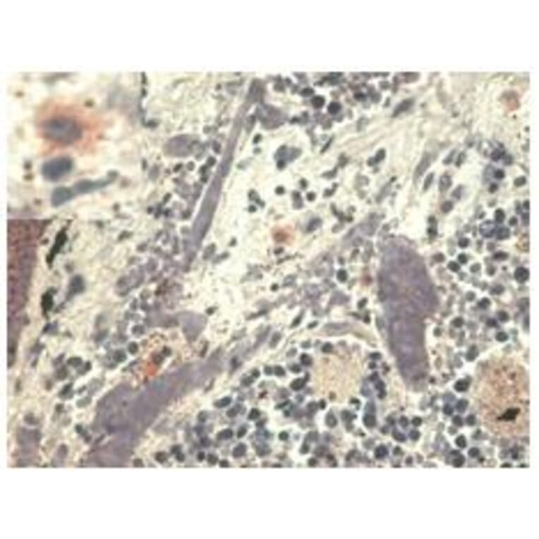 IHC - Anti-HLA G Antibody [MEM-G/1] (A86276)