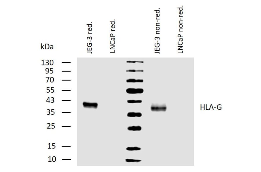 WB - Anti-HLA G Antibody [MEM-G/1] (A86276)
